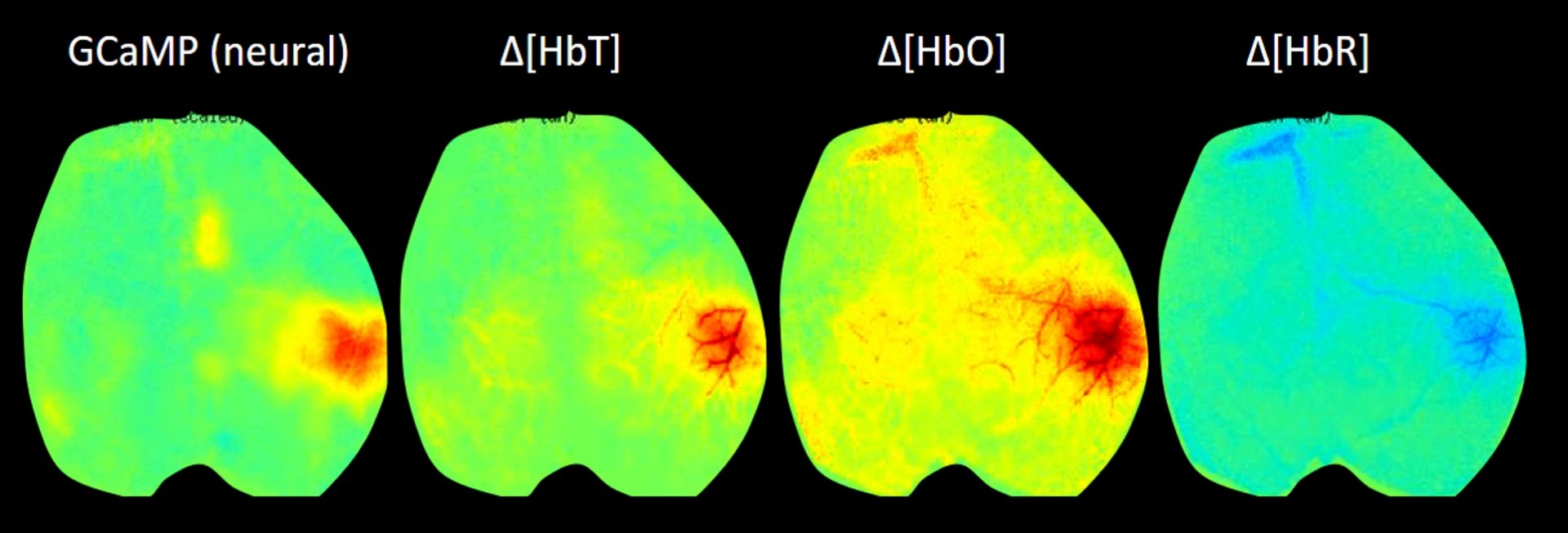 Widefield optical mapping of the neural and hemodynamic response to whisker stimulation