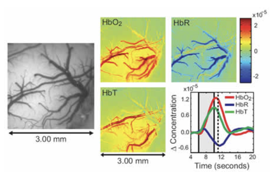 Multispectral optical intrinsic signal imaging (MS-OISI) data acquired on exposed rat somatosensory cortex during 4 second electrical hind-paw stimulation. Raw images acquired at interleaved blue (460 nm) and green (530 nm) illuminations were used to convert to maps of changing oxy-, deoxy- and total hemoglobin concentrations (HbO2, HbR and HbT). See Bouchard et al for more details.