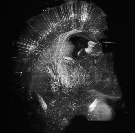 cleared brain imaged using SCAPE