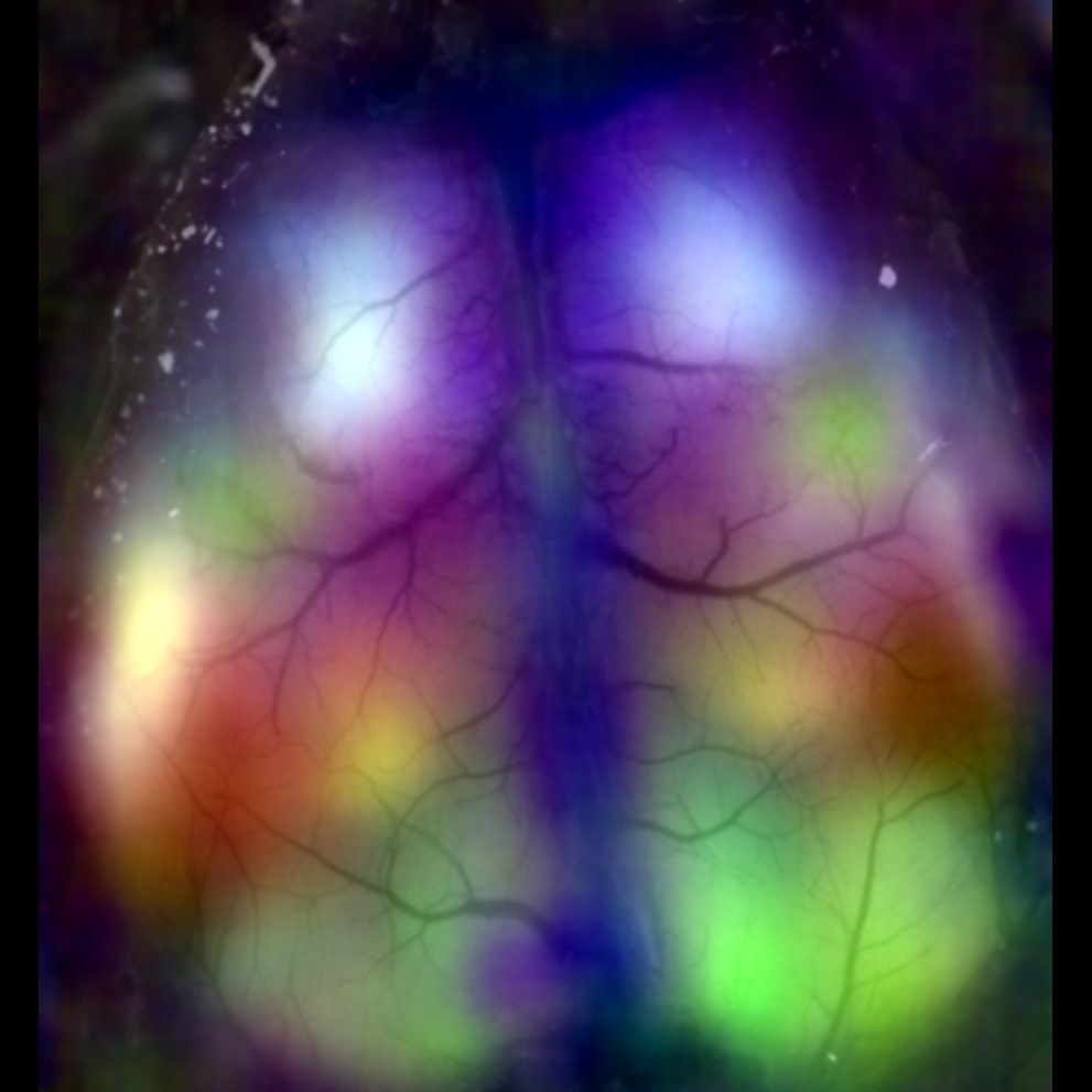 Patterns of resting state neural activity across the brain