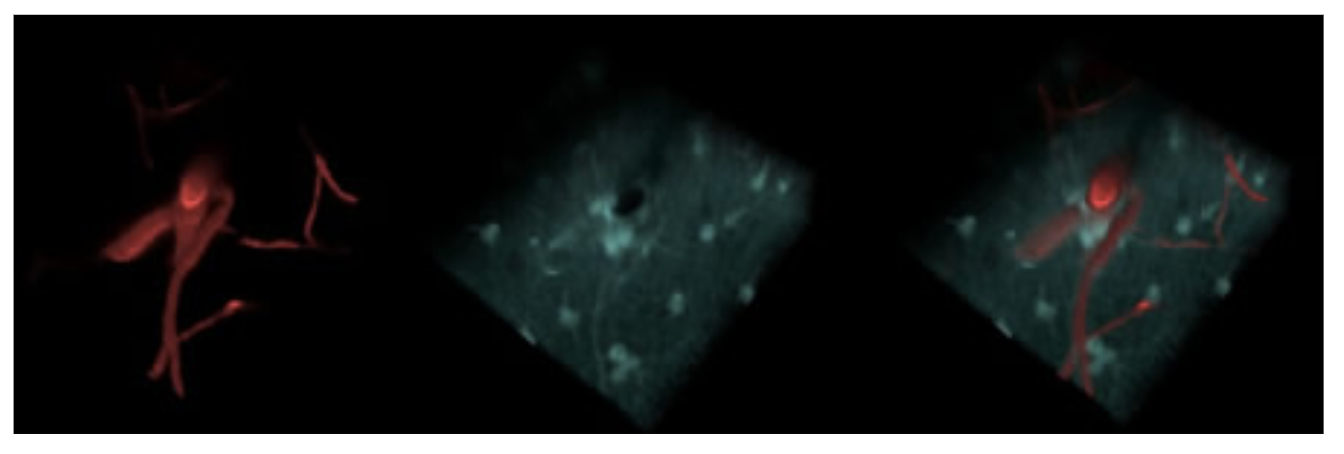 3D images of vasculature (dextran conjugated fluorescein) and astrocytes (SR101-stained) in-vivo. Each microscope channel can be anaylsed independently, or together. 