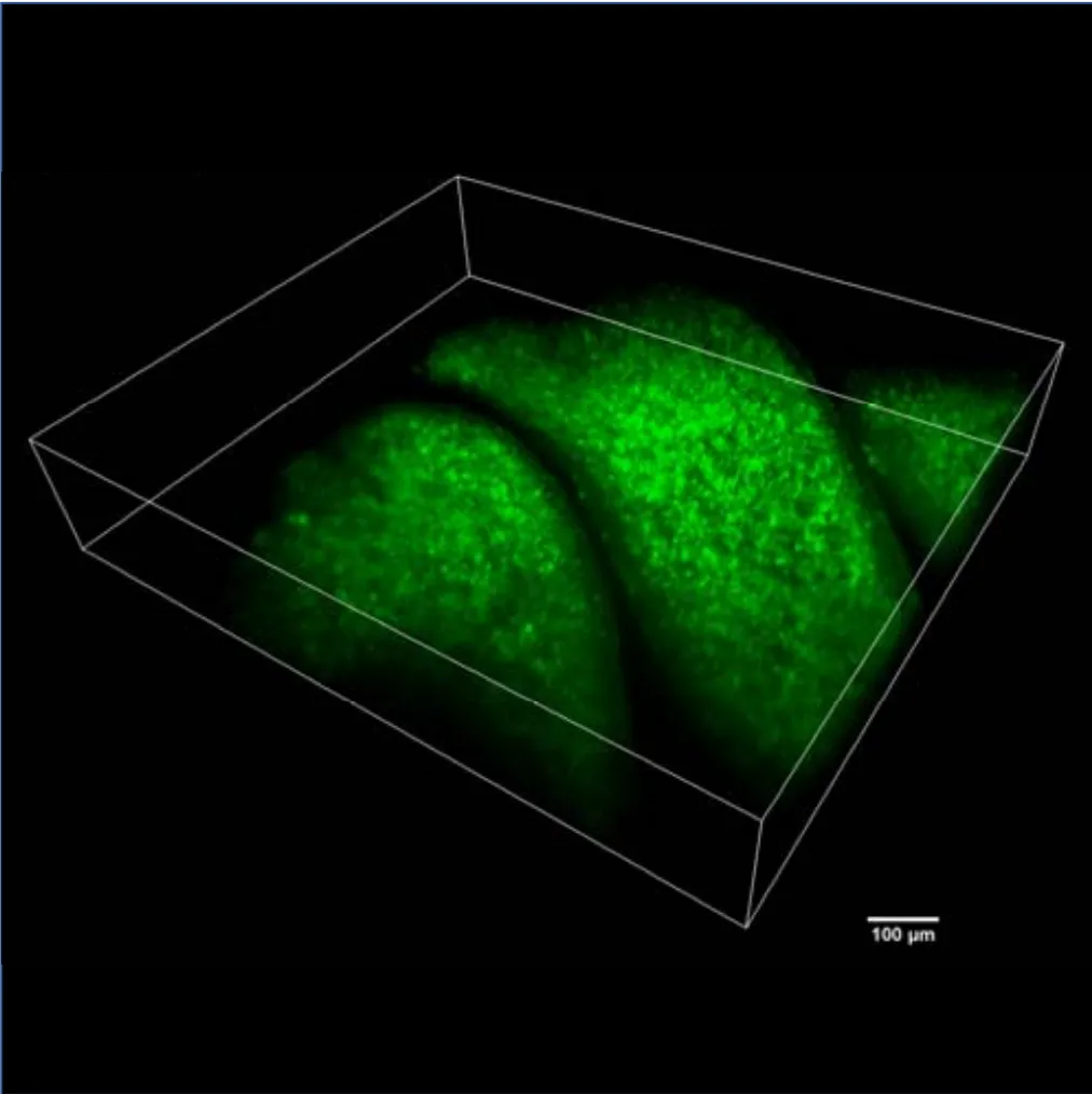 Olfactory Epithelium