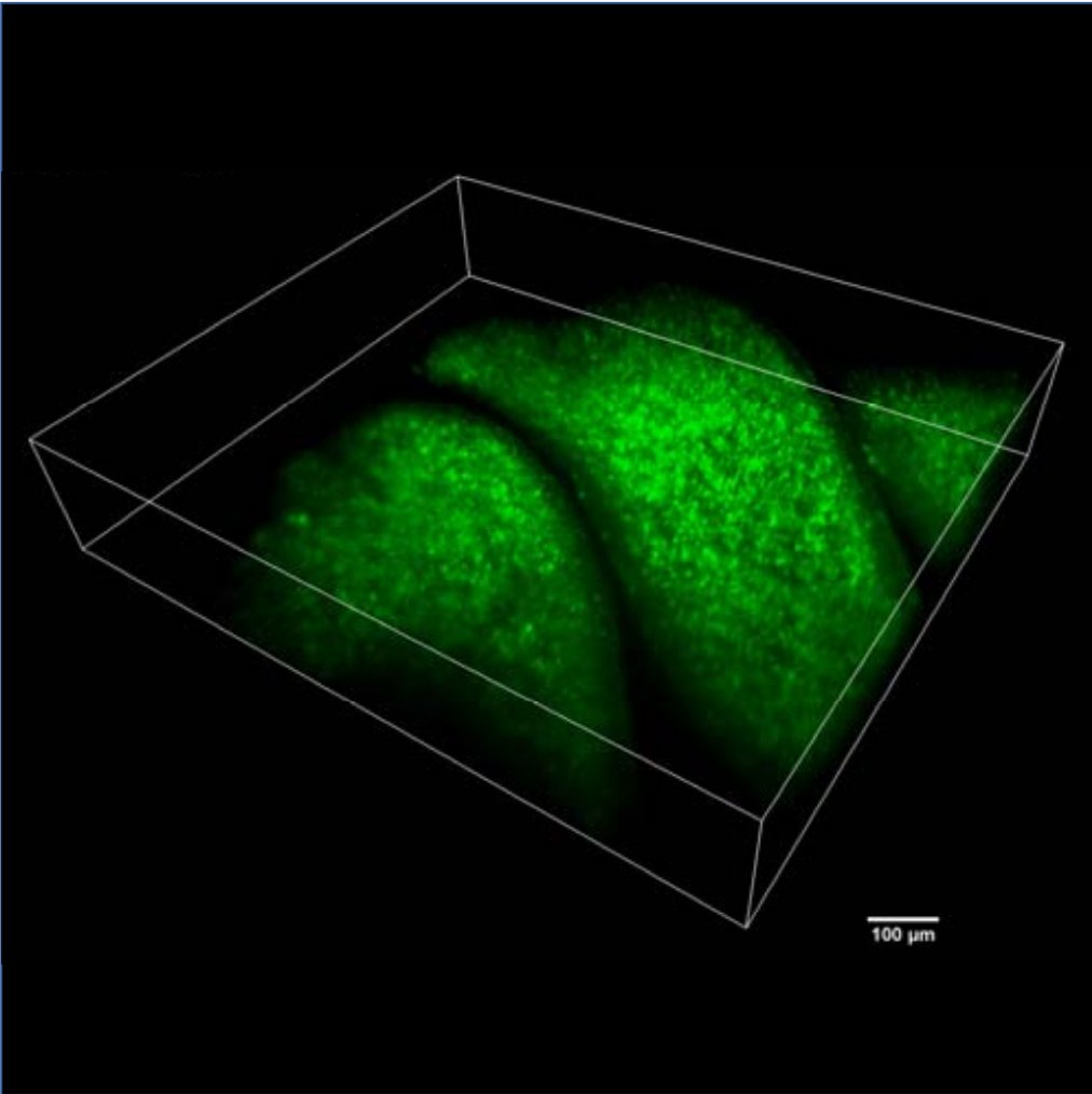 Olfactory Epithelium