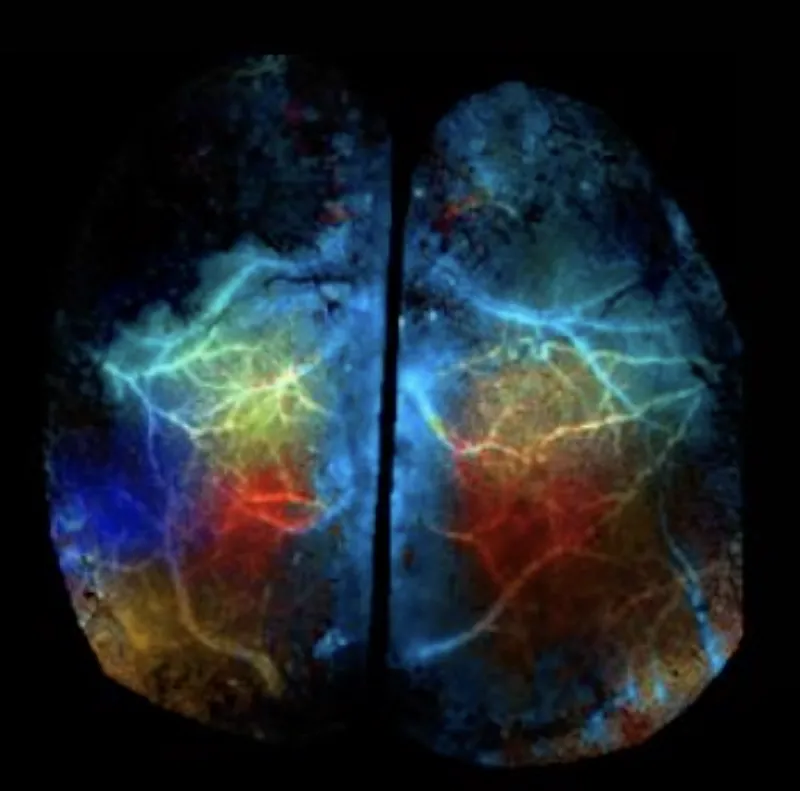 Neurovascular Coupling 