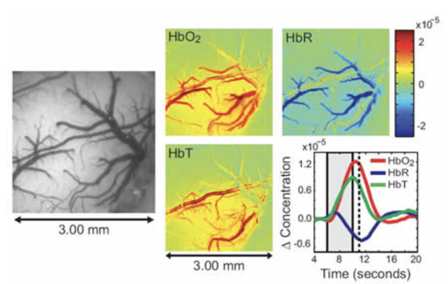 Multispectral optical intrinsic signal imaging (MS-OISI) data acquired on exposed rat somatosensory cortex during 4 second electrical hind-paw stimulation. Raw images acquired at interleaved blue (460 nm) and green (530 nm) illuminations were used to convert to maps of changing oxy-, deoxy- and total hemoglobin concentrations (HbO2, HbR and HbT). See Bouchard et al for more details. Multispectral optical intrinsic signal imaging (MS-OISI) data acquired on exposed rat somatosensory cortex during 4 second electrical hind-paw stimulation. Raw images acquired at interleaved blue (460 nm) and green (530 nm) illuminations were used to convert to maps of changing oxy-, deoxy- and total hemoglobin concentrations (HbO2, HbR and HbT). See Bouchard et al for more details.